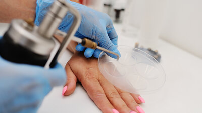 Application de l'azote liquide médical par le Cryal Jet en cryochirurgie. Air Liquide Healthcare Benelux.